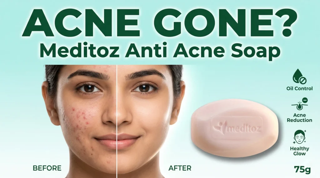 Meditoz Anti Acne Soap – Complete Skincare Solution for Clear & Healthy Skin 2 Website thamnail